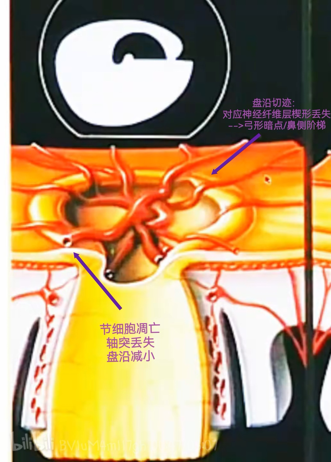 Pasted image 20250619211420