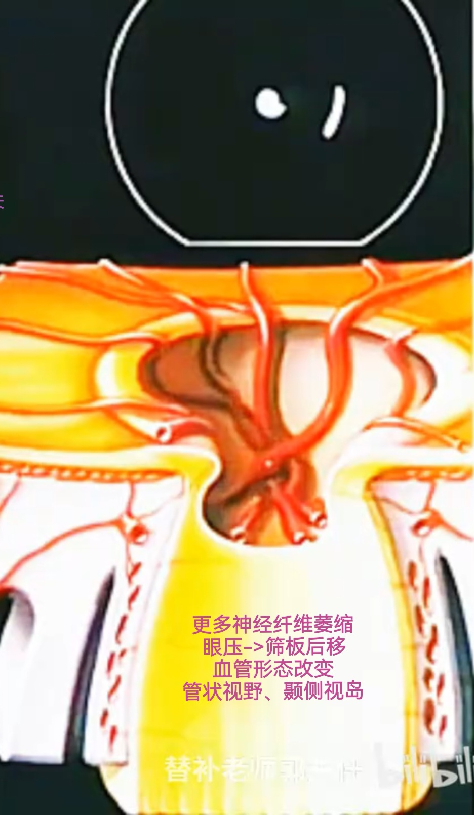 Pasted image 20250619211516